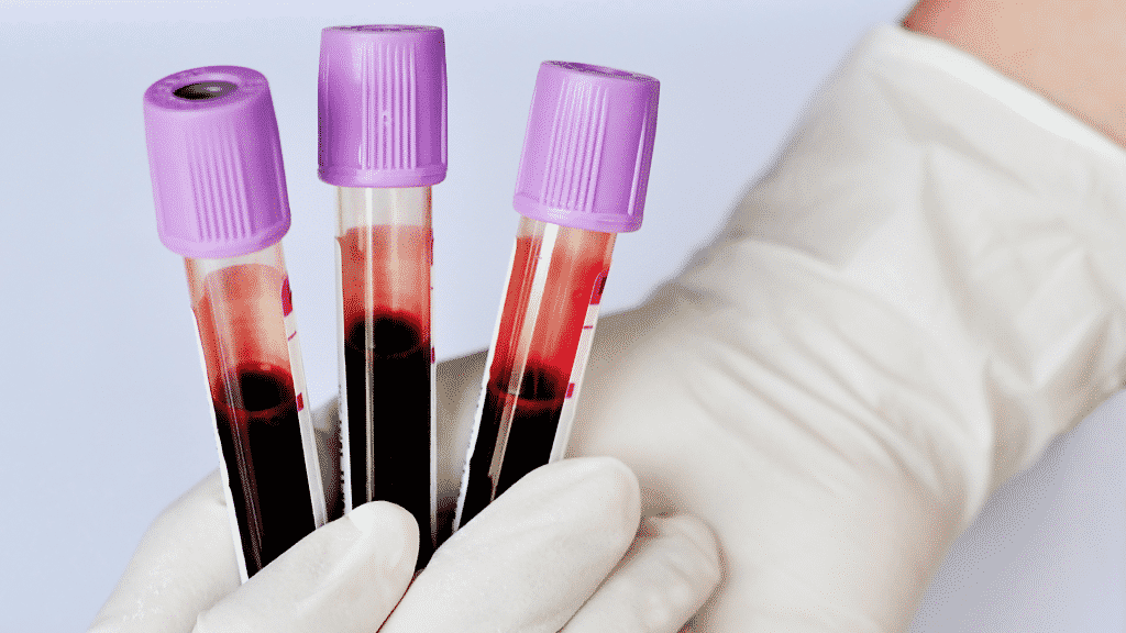 Três tubos de sangue coletados 