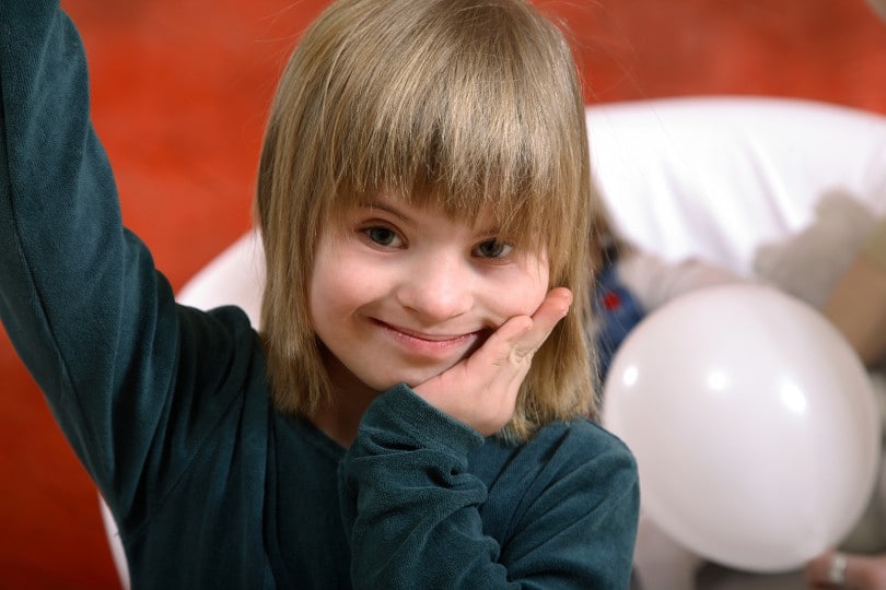 Menina com síndrome de down