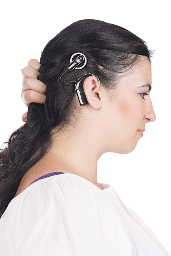 young deaf or hearing impaired woman showing her cochlear implant