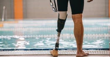 Homem à beira de piscina. Ele tem uma perna protética.