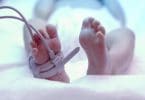 Pés do bebê recém-nascido sob lâmpada ultravioleta na incubadora