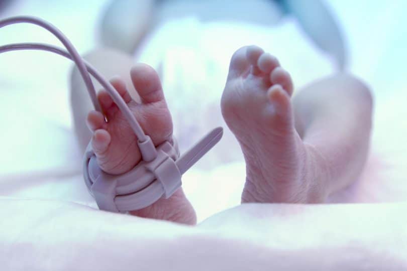 Pés do bebê recém-nascido sob lâmpada ultravioleta na incubadora