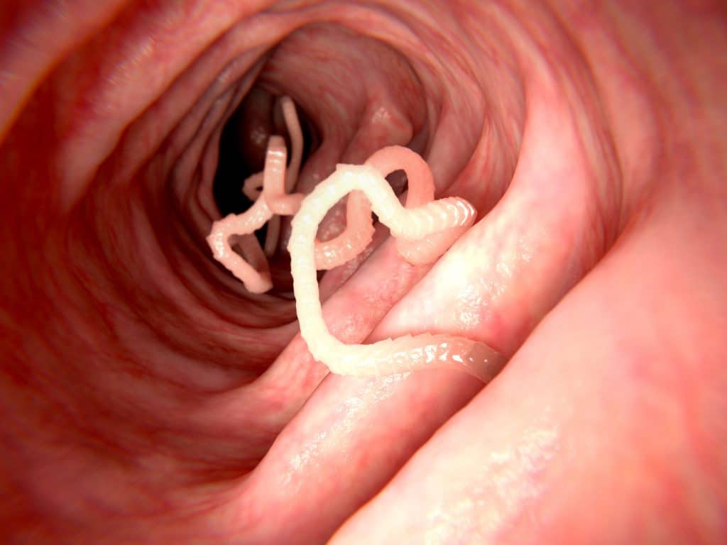 Larvas de tênia dentro de um intestino humano.