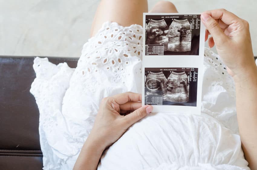 Mulher grávida sentada, olhando para fotos de um bebê em ultrassom.