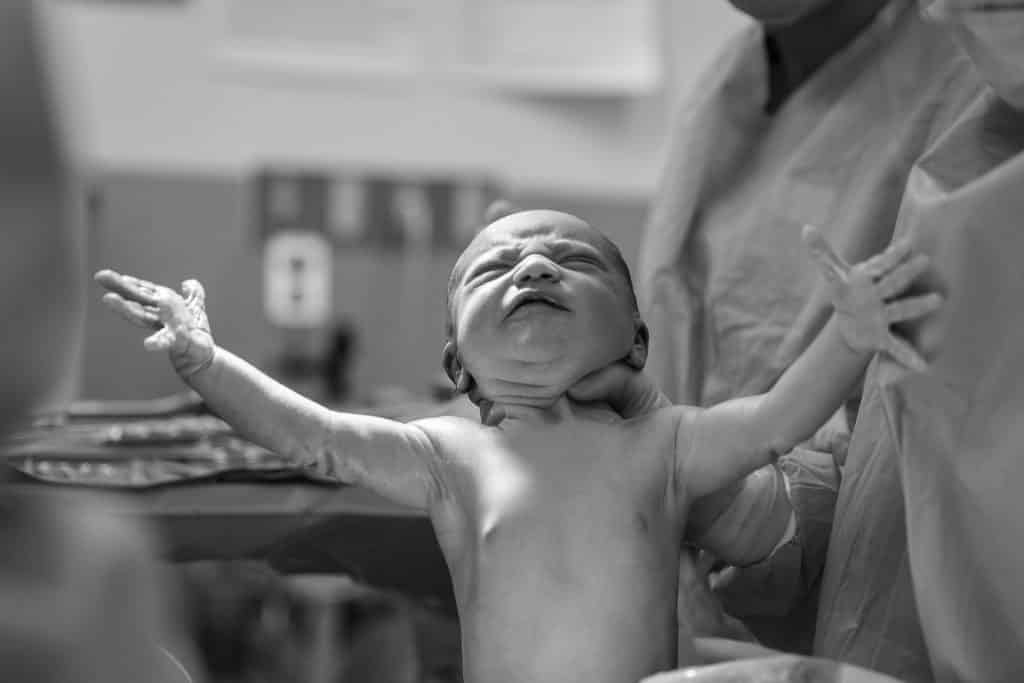 Bebê recém nascido de braços abertos segurado por um médico.