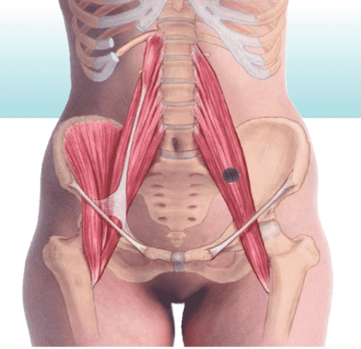 Imagem Ilustrativa do músculo Psoas em uma mulher