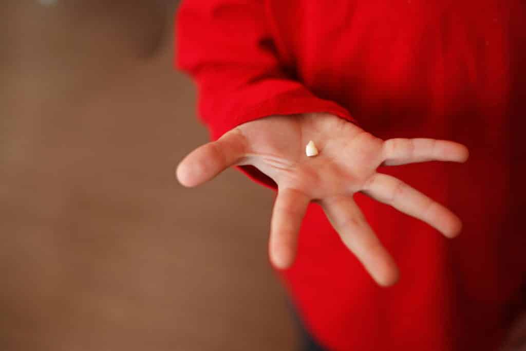 Criança segurando na palma da mão e mostrando seu dente que caiu.