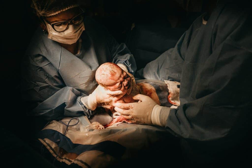 Criança nascendo por meio de uma cesariana