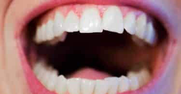 Uma boca sendo exibida de perto com dentes levemente tortos.