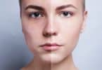 Duas fotografias divididas ao meio, representando uma face feminina, cada um dos lados. A primeira é mais escura, a segunda é mais clara.