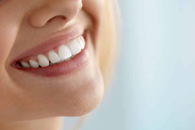 Recorte de um sorriso feminino com dentes brancos.