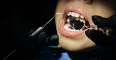 Pessoa passando no dentista