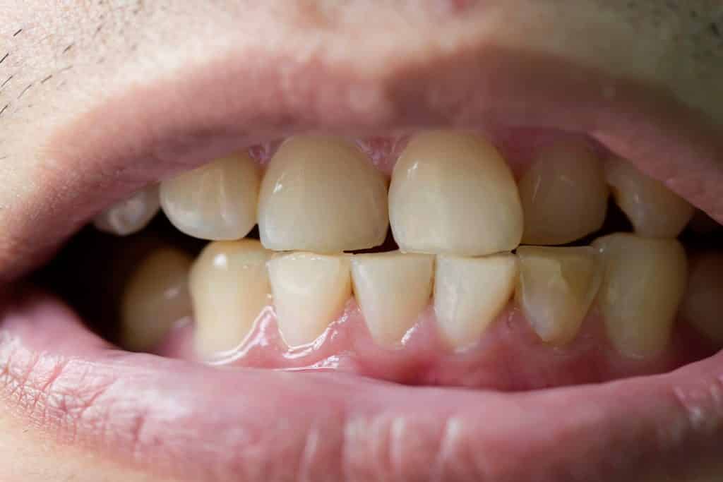 Pessoa mostrando os dentes