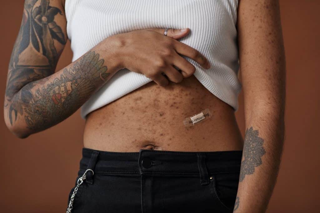 Mulher levantando a blusa e mostrando sua barriga.