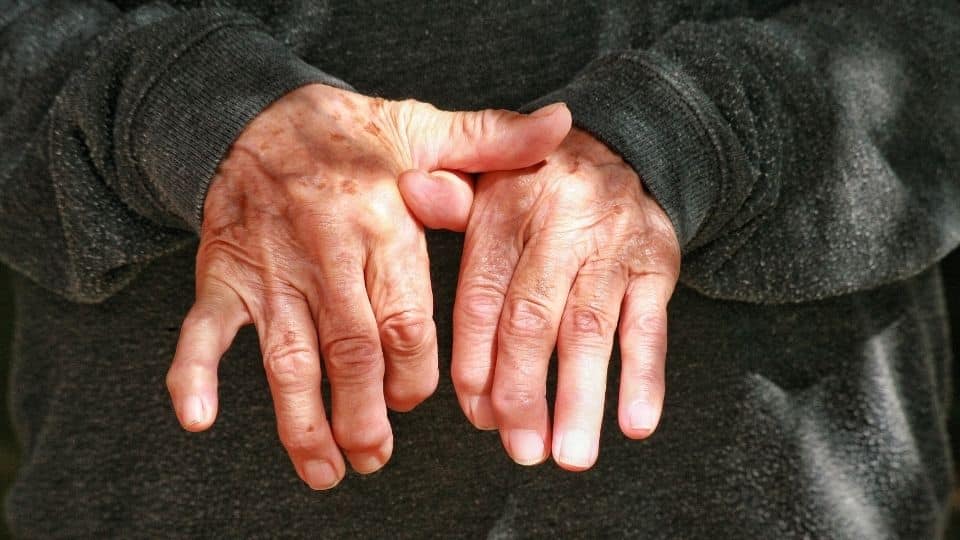 Mãos de um idoso com osteoporose. 