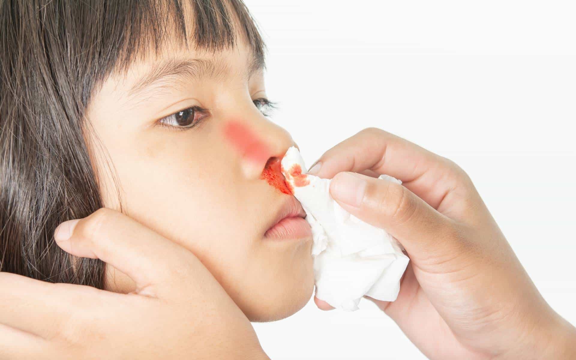 Um adulto estancando, com um papel, um sangramento nasal de uma criança.