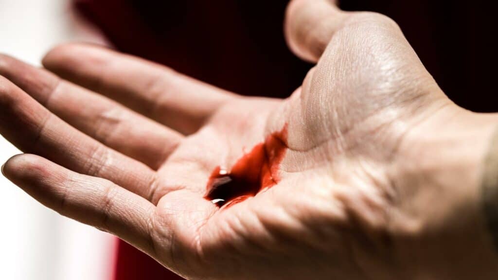 Uma mão sangrando.