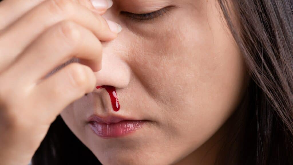 Uma mulher que tem o nariz sangrando.