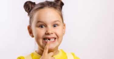 Uma criança apontando à sua própria boca, a qual há a ausência de um dente que pertence ao meio.