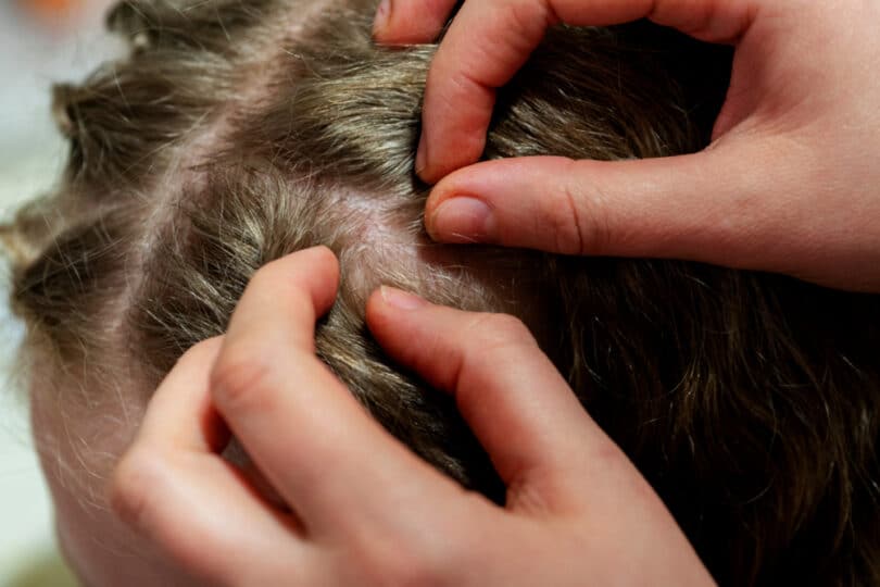 Mãe tirando piolho do cabelo da criança