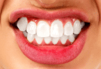 Mulher mostrando seus dentes brancos