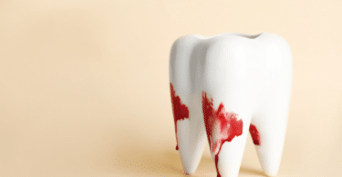 Representação de um dente com sangue