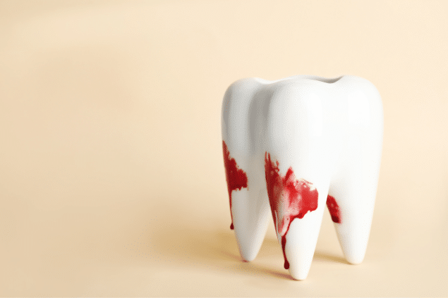 Representação de um dente com sangue