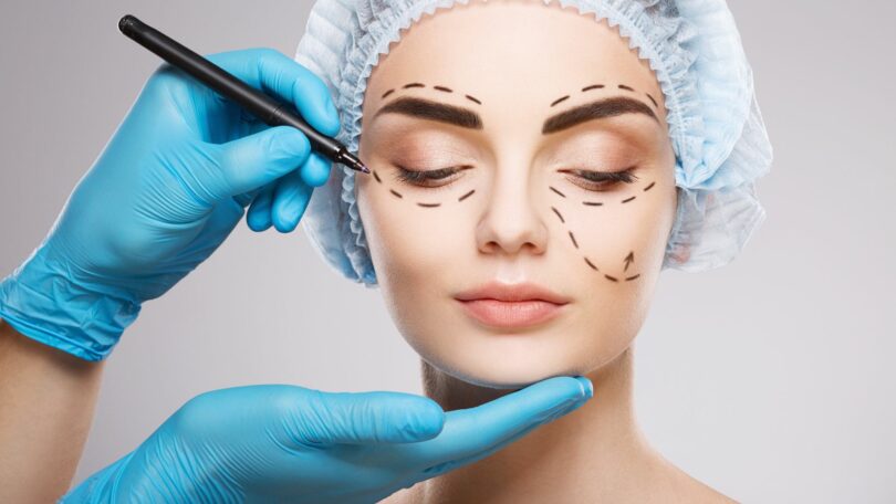 Imagem do rosto de uma mulher sendo desenhado por um médico para fazer um procedimento cirúrgico na região dos olhos e bochecha.